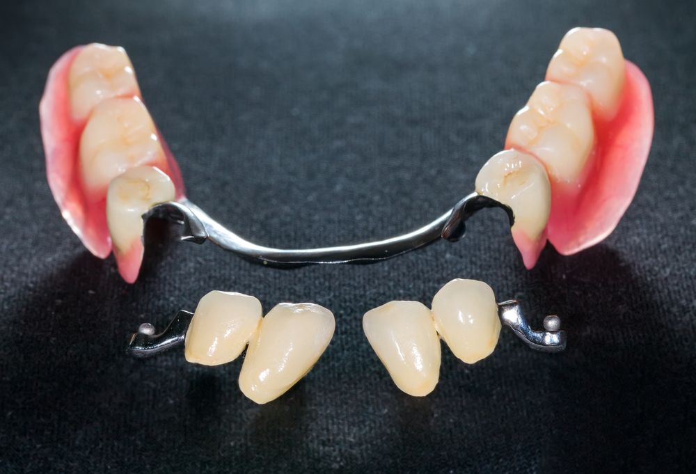 Ventajas Y Desventajas De Las Prótesis Dentales - Multiestetica.mx